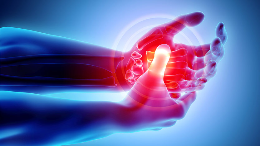 The 10 Key Nutrients to Treat Your Arthritis Immediately