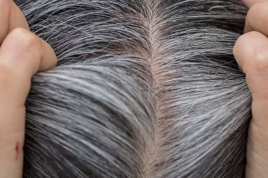 How to Reverse Grey Hair Naturally Through Diet