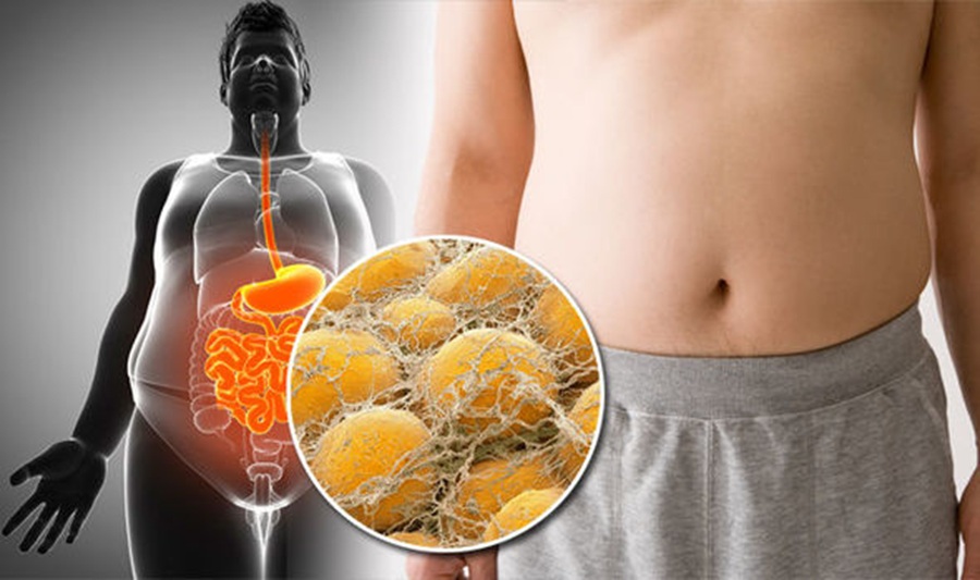 Natural Ways to Reduce Visceral Fat Using Food and Herbs